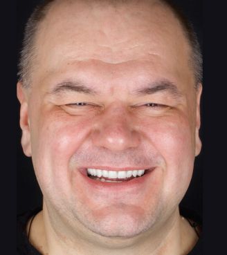 Фотография пациента